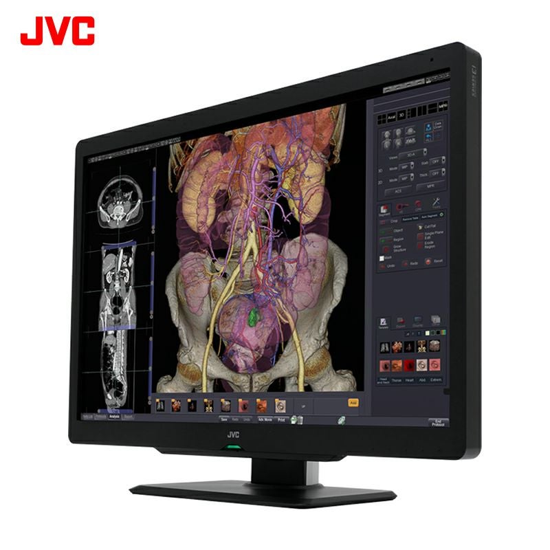 600万画素30型カラー液晶モニター JESRA X-0093(管理グレード1A)対応