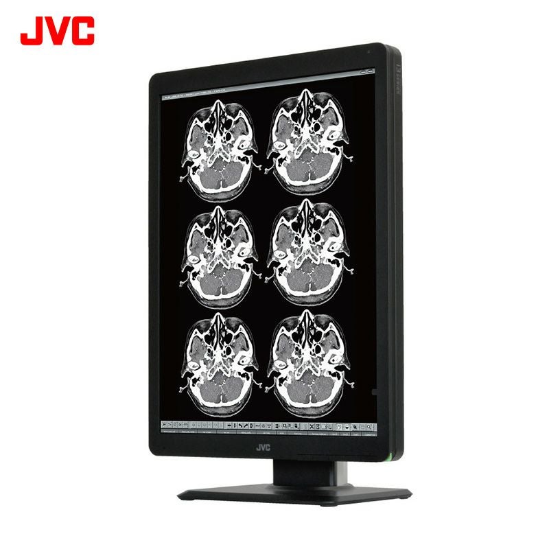 200万画素21.3型モノクローム液晶モニター JESRA X-0093(管理グレード