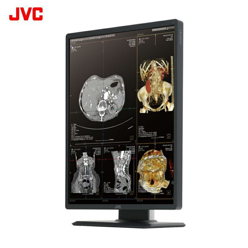 医用画像表示モニター | JVCケンウッドストア